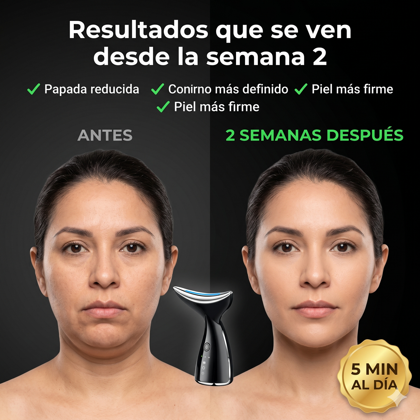 Velura™ Masajeador Facial Antiarrugas | Lifting Visible en 2 Semanas